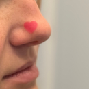 Pimple Patch Hearts – 72 Hydrocolloid Patches in 2 Heart Sizes with Tea Tree Oil